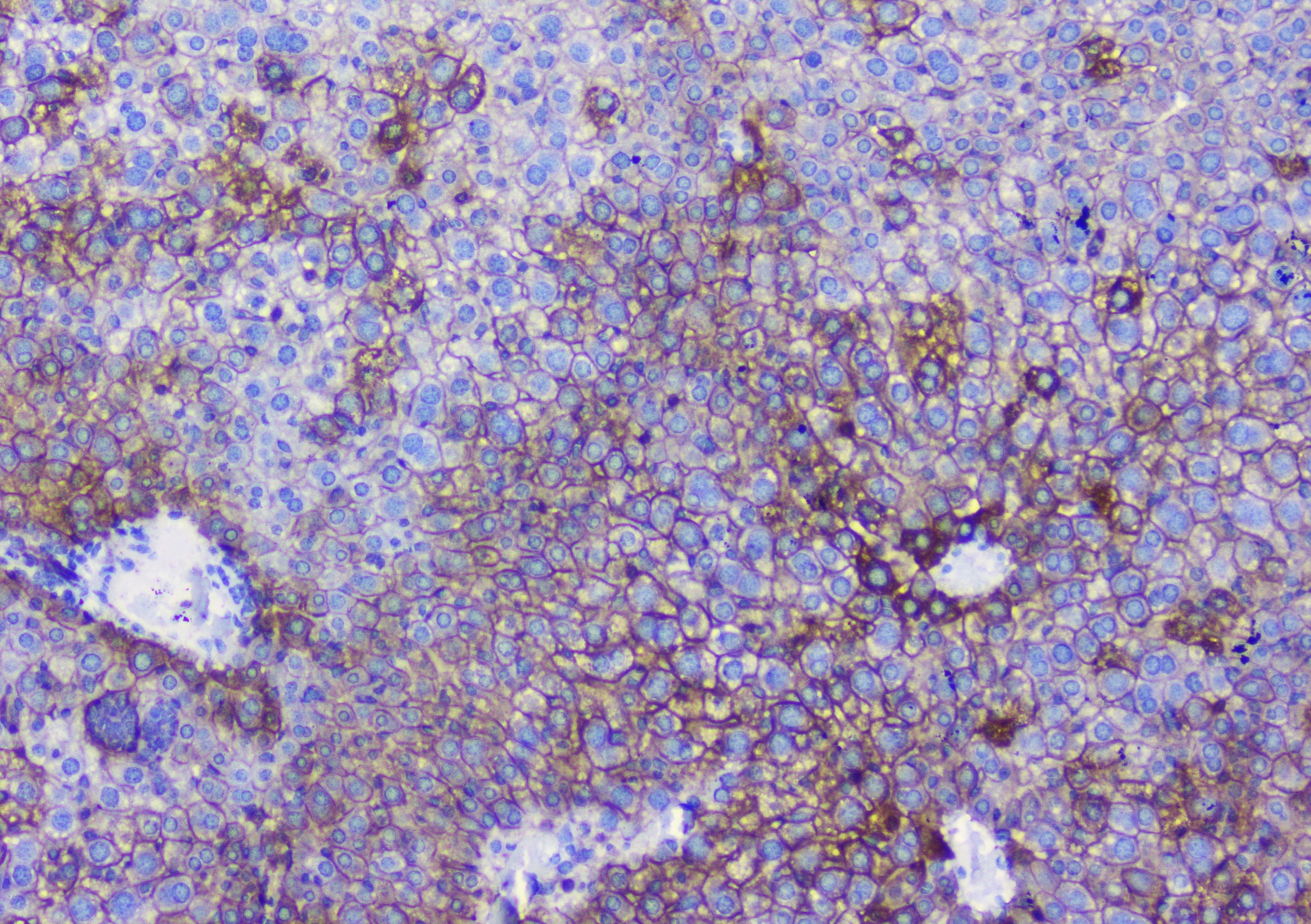 CTNNB1 / Beta Catenin Antibody