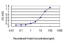 IHC-plus™ Monoclonal Mouse anti-Human CSE1L Antibody (clone 2F4, IHC, IF, WB)