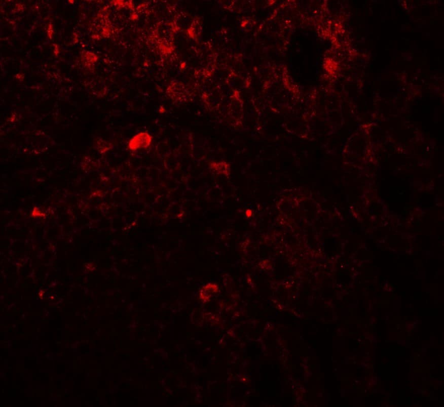 IHC-plus™ TRIP12 Antibody