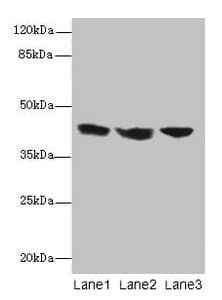 IL2RG / CD132 Antibody