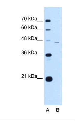 Polyclonal Rabbit anti-Human SIGLEC9 Antibody (aa308-357, IHC, WB)