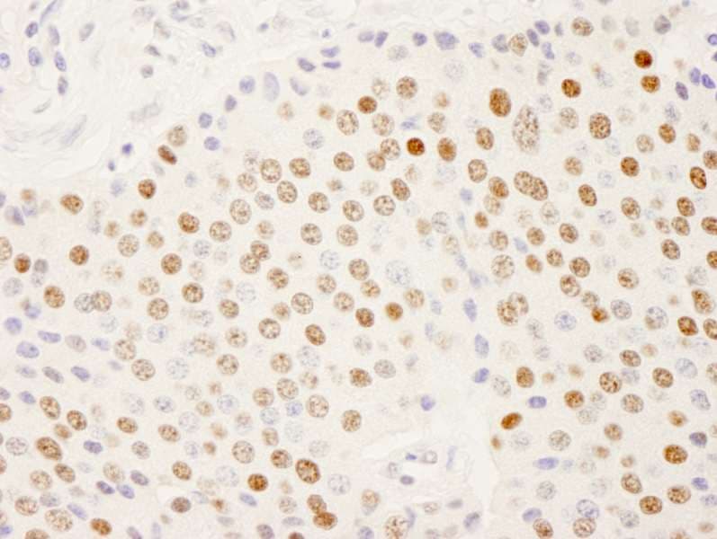 Polyclonal Rabbit anti-Human SUGP2 / SFRS14 Antibody (aa725-775, IHC, IF)