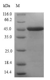 Human CETN1 Protein (Recombinant GST, N-terminus)