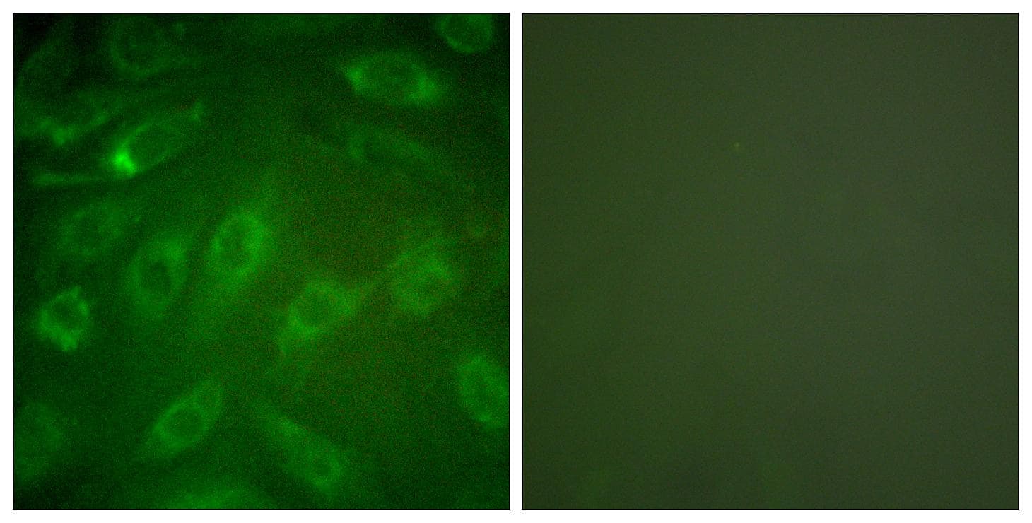 Collagen I Antibody