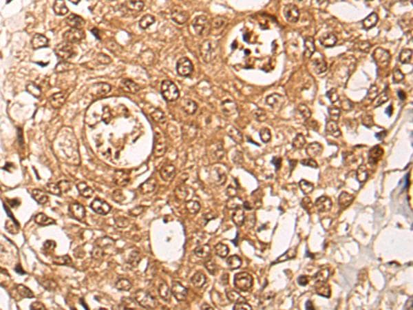 ZPR1 / ZNF259 Antibody