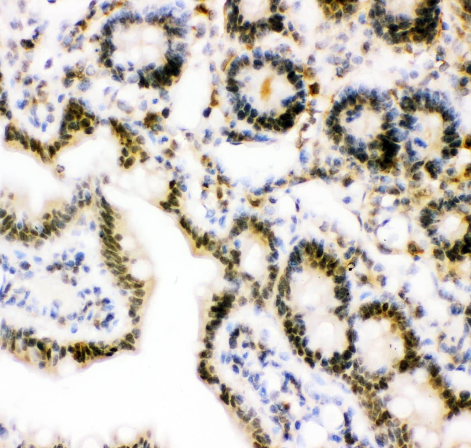 Polyclonal Rabbit anti-Human UBB / Ubiquitin B Antibody (aa77-152, IHC, WB)