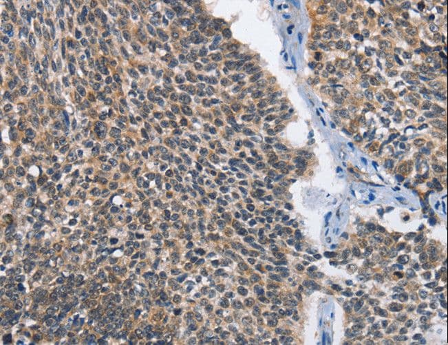Polyclonal Rabbit anti-Human CMT2 / MAD2L1BP Antibody (IHC)