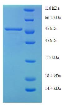Human AGXT / SPT Protein (Recombinant 6His, N-terminus)