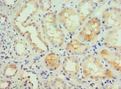 KCNN4 / KCa3.1 Antibody (aa288-427)