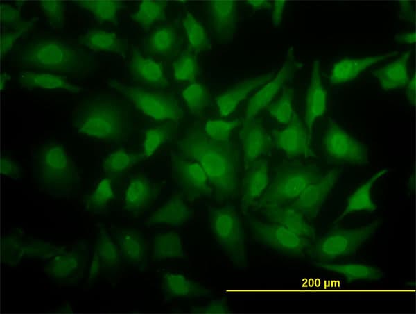 IHC-plus™ YBX1 / YB1 Antibody (clone 4F12)