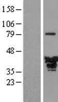 MAPRE2 / EB2 Protein (Over-Expression Lysate Myc-DDK (Flag))