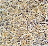 HCK Antibody (aa131-156)