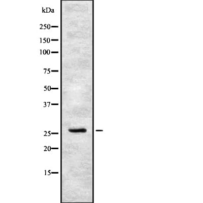 FSP27 / CIDEC Antibody