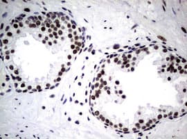 NBN / Nibrin Antibody (clone OTI6E11)