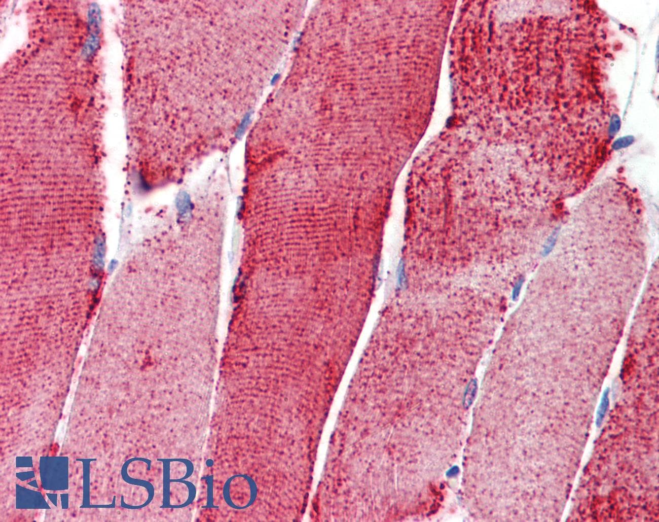 ACTN3 Antibody (aa180-229)