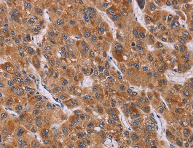Polyclonal Rabbit anti-Human CALCA Antibody (IHC)