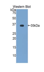ZAP70 Antibody (aa337-600)