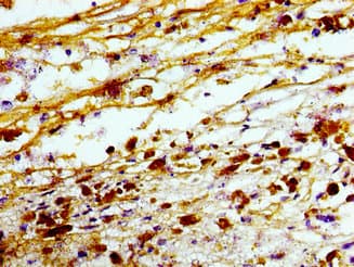 Polyclonal Rabbit anti-Human TREM2 / TREM-2 Antibody (IHC)