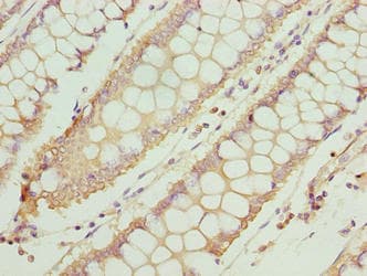 Polyclonal Rabbit anti-Human TTC30A Antibody (IHC, WB)