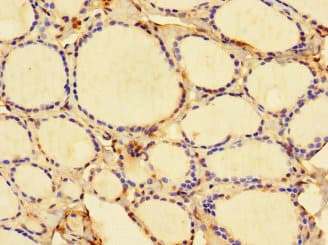 Polyclonal Rabbit anti-Human DBR1 Antibody (IHC)