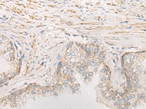 STOML2 Antibody