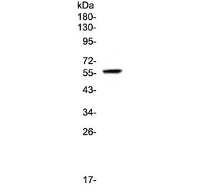 Polyclonal Rabbit anti-Human FGR Antibody (WB)