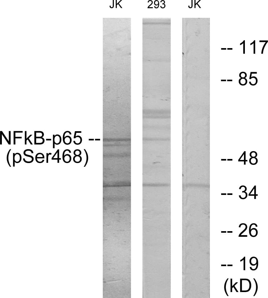RELA / NFKB p65 Antibody (phospho-Ser468)
