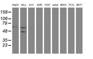 SENP2 Antibody (clone OTI3H10)