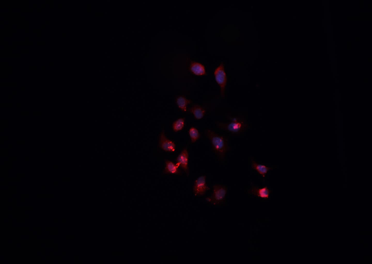AKAP8 / AKAP95 Antibody