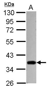 IHC-plus™ Polyclonal Rabbit anti-Human STUB1 / CHIP Antibody (IHC, WB)