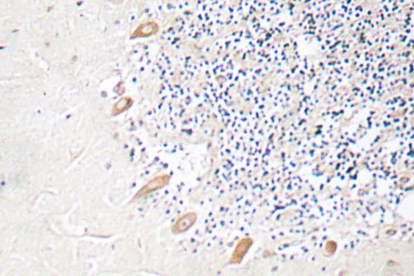GABRB2 Antibody (Arg431)