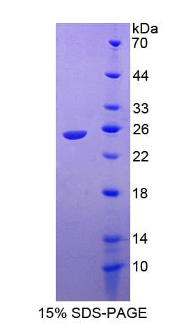 Human RAC1 Protein (Recombinant His-S)