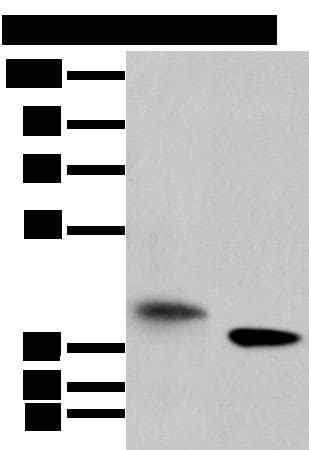 Polyclonal Rabbit anti-Human LRRC19 Antibody (IHC, WB)