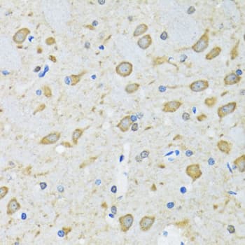 Polyclonal Rabbit anti-Human Apg7 / ATG7 Antibody (IHC, WB)