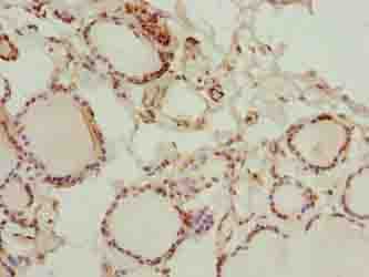 GLT1D1 Antibody