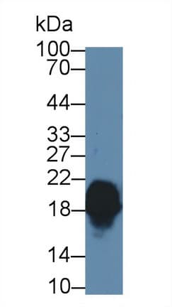CPLX1 / Complexin 1 Antibody (APC, Cy7)