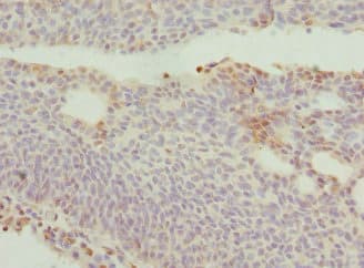 Polyclonal Rabbit anti-Human DRAM2 Antibody (IHC, IF, WB)