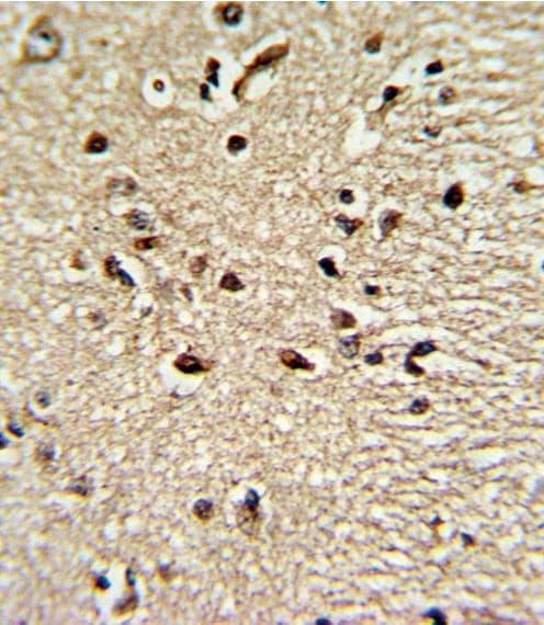 Polyclonal Rabbit anti-Human PAX4 Antibody (aa171-200, IHC, WB)