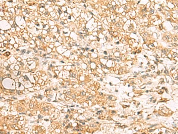 USP24 Antibody