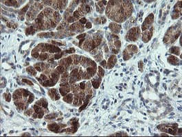 CDKN2B / p15 INK4b Antibody (clone OTI3B6)
