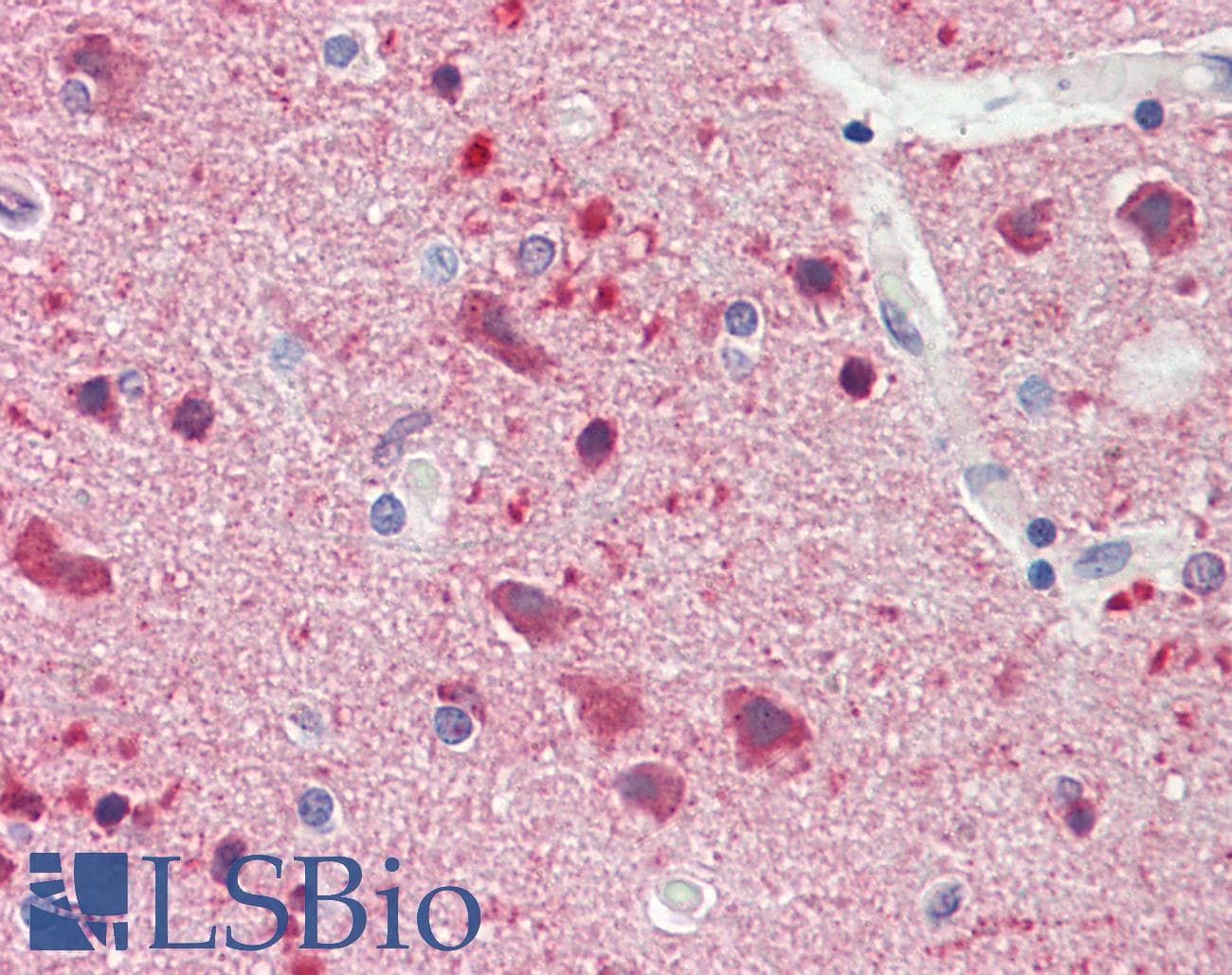 IHC-plus™ JMY Antibody (aa931-980)