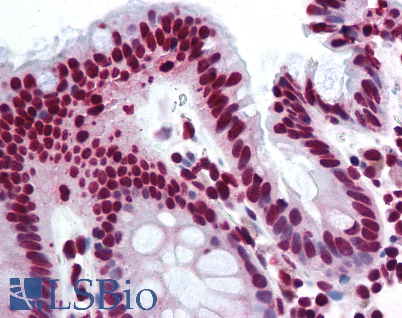 IHC-plus™ Polyclonal Rabbit anti-Human THRAP3 / TRAP150 Antibody (aa930-955, IHC, WB)