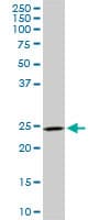 DCUN1D1 / SCCRO Antibody (clone 4B5)