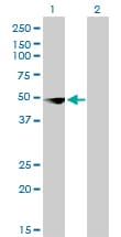 YBX3 / CSDA Antibody (clone 4D9)