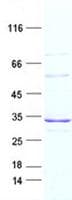 Human ABCB1 / MDR1 / P Glycoprotein (Recombinant DDK,C-terminus)
