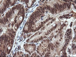 VHL / Von Hippel Lindau Antibody (clone OTI1E1)