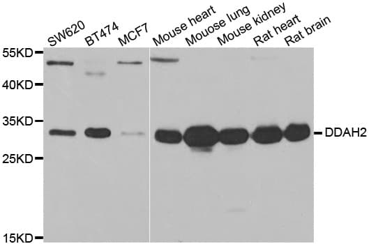 Polyclonal Rabbit anti-Human DDAH2 Antibody (IHC, IF, WB)