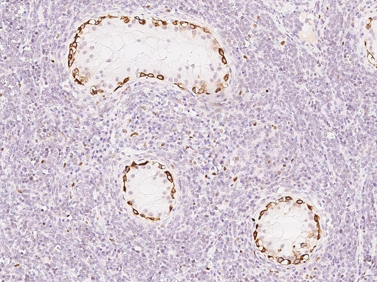 HDAC6 Antibody (Preservative Free)