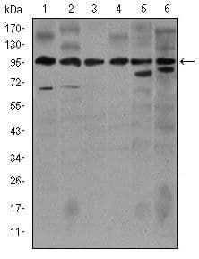 NOS2 / iNOS Antibody (clone 400000)