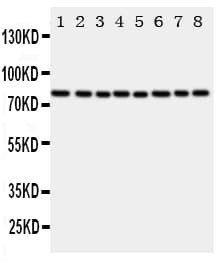 Polyclonal Rabbit anti-Human CYPOR / POR Antibody (aa659-677, IHC, WB)